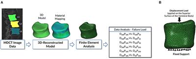 Finite Element Analysis-Based Vertebral Bone Strength Prediction Using MDCT Data: How Low Can We Go?